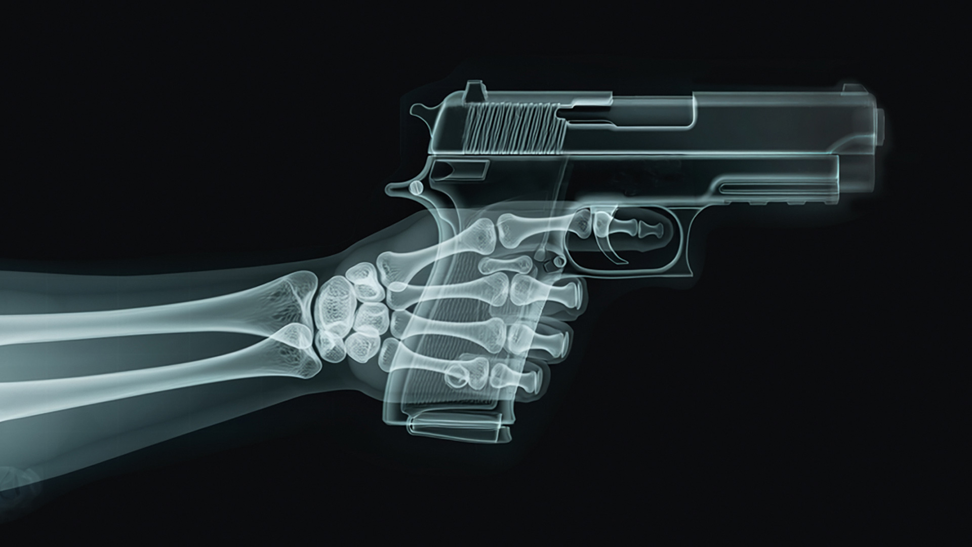 Xray of hand with pistol
